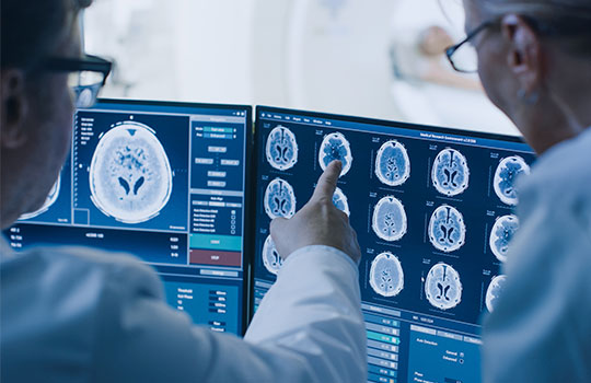 Radiografías del cerebro efectos cocaína